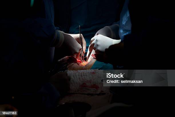 Nahaufnahme Heart Surgery Stockfoto und mehr Bilder von Bypassoperation - Bypassoperation, Kranzschlagader, Herzoperation