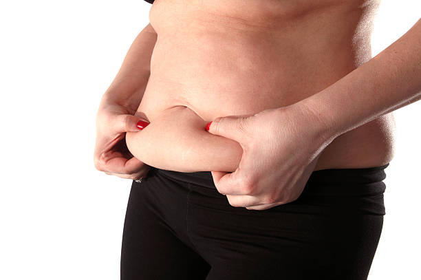 barriga de gordura - overweight tummy tuck abdomen body imagens e fotografias de stock