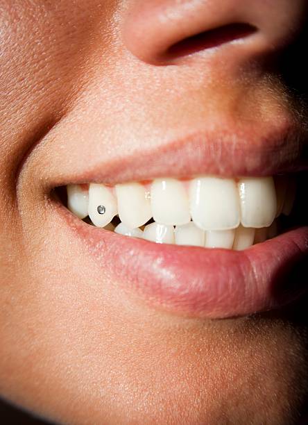 Dental circon stock photo
