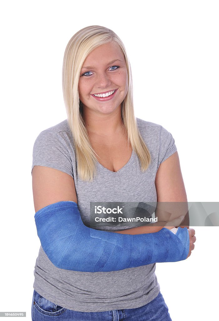 Broken Arm - Lizenzfrei Gebrochener Arm Stock-Foto
