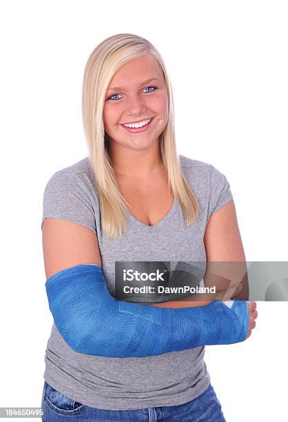Broken Arm Stockfoto und mehr Bilder von Gebrochener Arm - Gebrochener Arm, Eine Person, Gipsverband