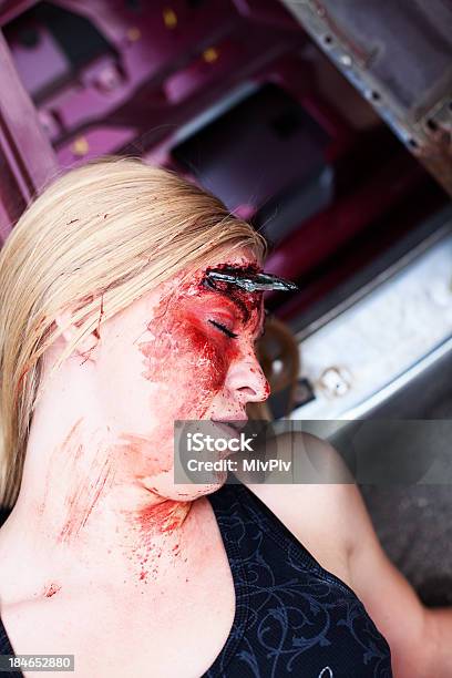 Teenage Girl With Head Injury Stock Photo - Download Image Now - Car, Car Accident, Teenage Girls