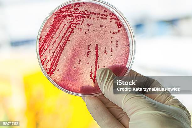 Foto de Disco De Petri Com Bactérias e mais fotos de stock de Antibiotico - Antibiotico, Bactéria, Biologia