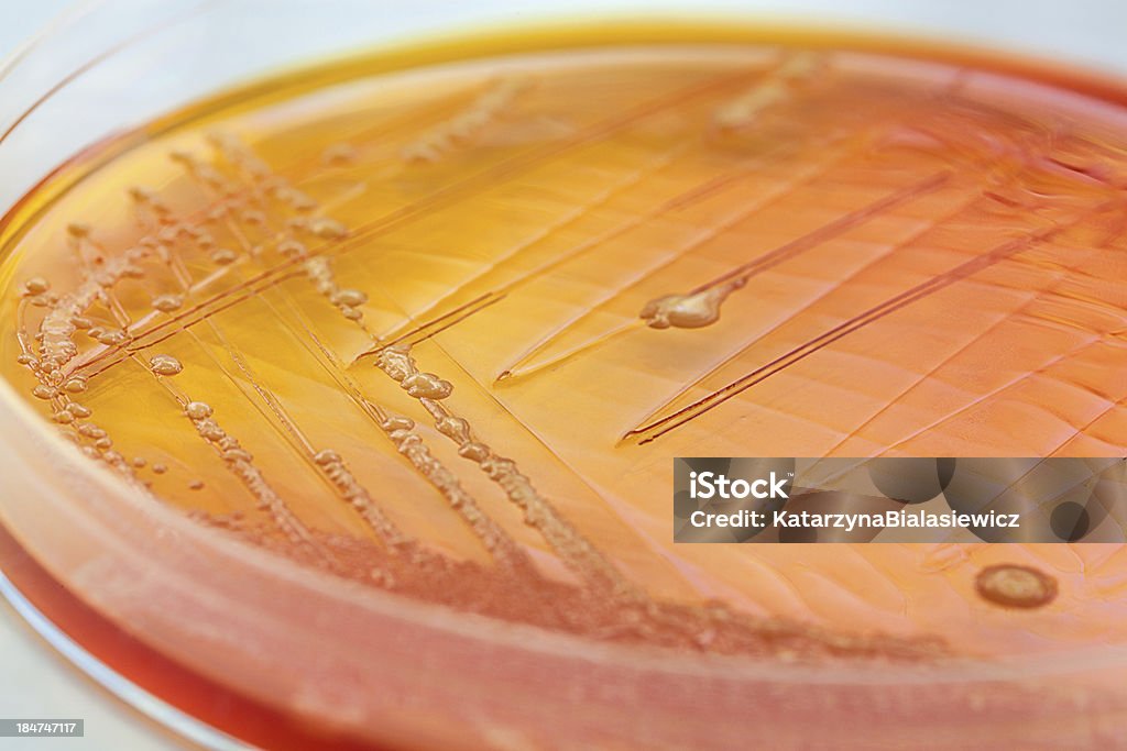 Orange bacteria Closeup of an orange bacteria in a petri dish Petri Dish Stock Photo