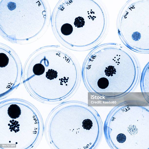 Crescimento De Bactérias Em Placas De Petri - Fotografias de stock e mais imagens de Cor verde - Cor verde, Disco de Petri, Loiça