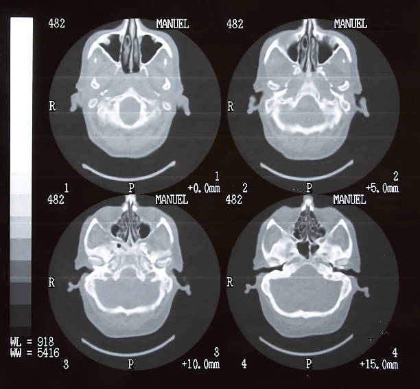 istock Photograph of a brain tomography exam 184774025
