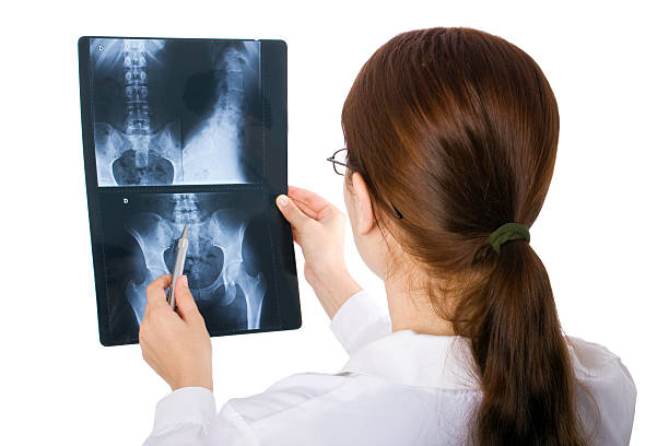 femme médecin examine un x-ray - x ray image coccyx radiologist hip photos et images de collection