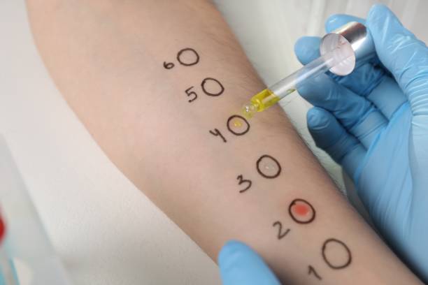 istock Doctor doing skin allergy test at light table, closeup 1848172287