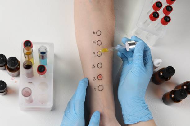 istock Doctor doing skin allergy test at light table, top view 1848172288