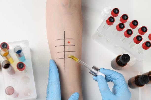 istock Doctor doing skin allergy test at light table, top view 1848172822