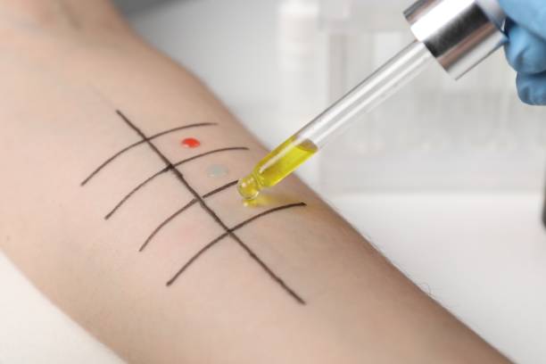 istock Patient undergoing skin allergy test at light table in clinic, closeup 1848172825