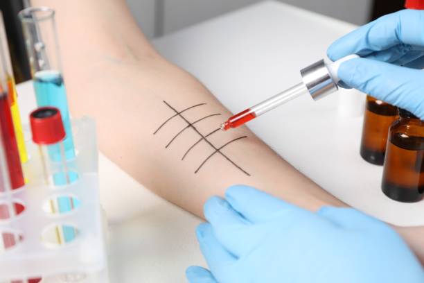 istock Doctor doing skin allergy test at light table, closeup 1848174384