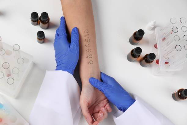 istock Doctor doing skin allergy test at light table, top view 1848175454