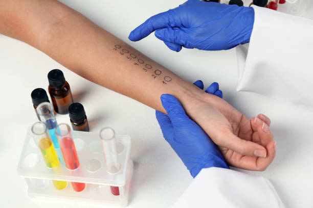 istock Doctor doing skin allergy test at light table, closeup 1848177221