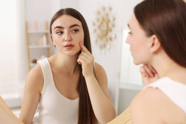 istock Young woman with skin problem looking at mirror indoors 1848177627