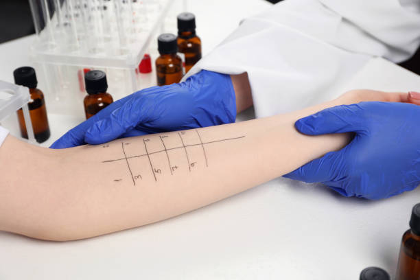 istock Doctor doing skin allergy test at light table, closeup 1848179232