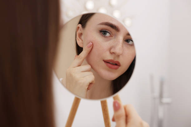 istock Young woman with skin problem looking at mirror indoors, closeup 1848179242