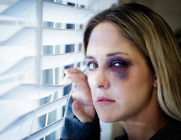 istock Woman with a Black Eye 184843280