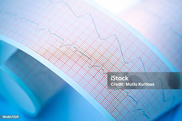 Ecg - Fotografie stock e altre immagini di Apparecchiatura medica - Apparecchiatura medica, Attrezzatura, Attrezzi da lavoro