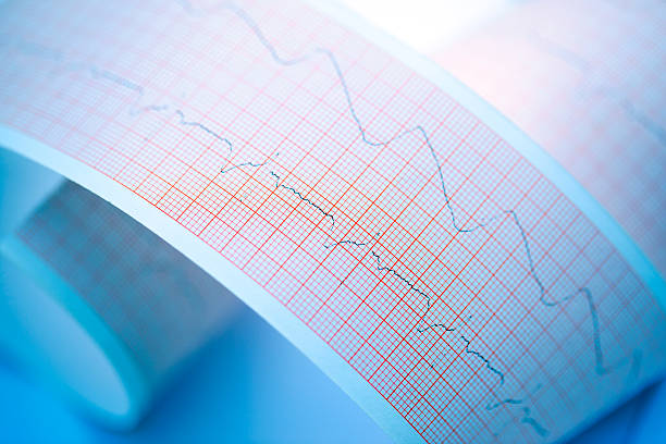 istock Echocardiogram printout of a hearts beating patterns  184847259