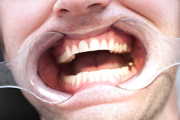 Child, Children Only, Toothy Smile, Brushing Teeth, Dental check-up