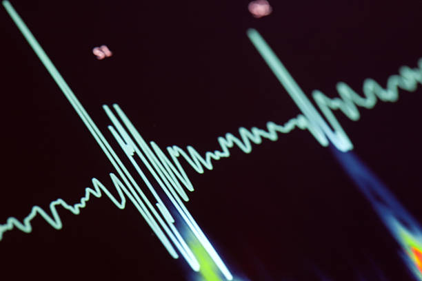 A blue heartbeat trace on a screen stock photo