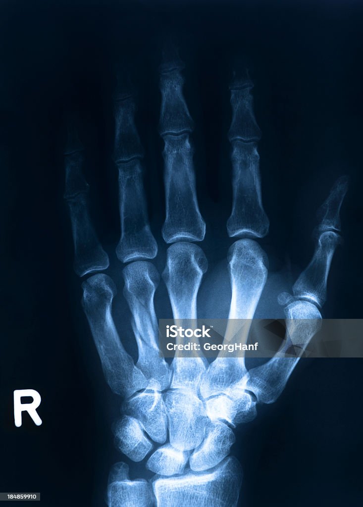 Osso da Mão humana - Foto de stock de Anatomia royalty-free
