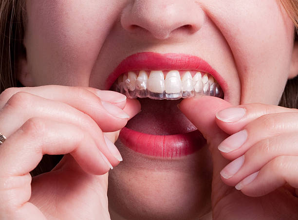 istock Woman Putting Plastic Dental Retainer on Teeth 184873998