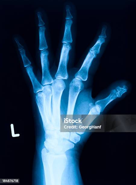 Mão Humana Ossos - Fotografias de stock e mais imagens de Articulação - Parte do corpo - Articulação - Parte do corpo, Criação Digital, Imagem de raios X