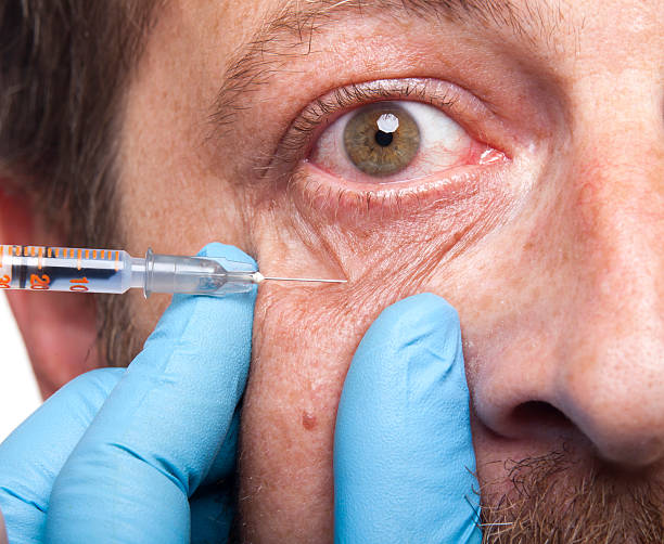 240+ Red Eye Drops Stock Photos, Pictures & Royalty-Free Images - iStock