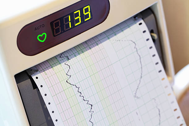 心拍数モニタ - pulse trace surveillance machine healthcare and medicine ストックフォトと画像