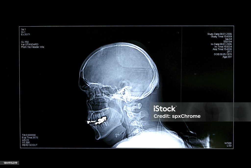 Tête X-Ray - Photo de Imagerie par rayons x libre de droits