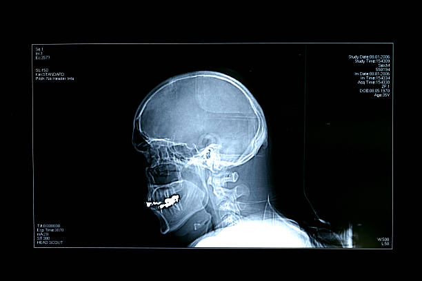 head x 線 - radiologist cat scan x ray cat scan machine ストックフォトと画像