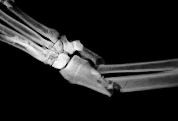 fracture dog x-ray imagePlease see more in my Sience and medicine LB: