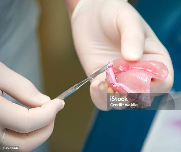 Get New Prothesis At The Dentist Stock Photo - Download Image Now - Dentures, Body Care, Clean