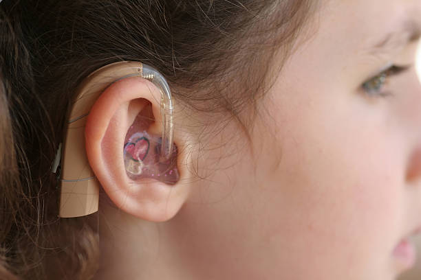 mädchen mit einem hörgerät - hearing aid audiologist audiology small stock-fotos und bilder