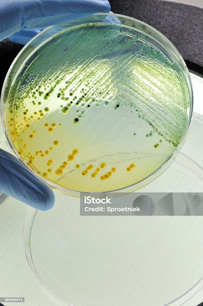 Jeszcze fala zakażeń bakterią E.coli, rosnące w naczynie - Zbiór zdjęć royalty-free (Escherichia coli)