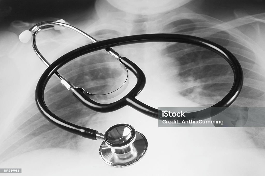 Stetoscopio Sdraiato su un medico radiografie del torace e dei polmoni umani - Foto stock royalty-free di Ospedale