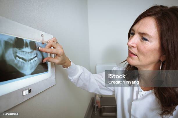 Dental Professionellen Überprüfen Ein Xray Patientens Stockfoto und mehr Bilder von Arbeiten