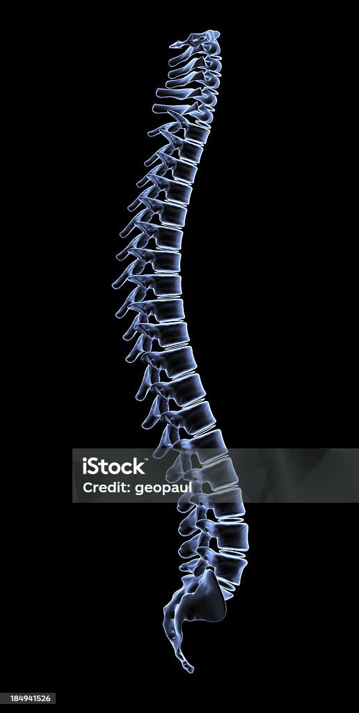 Spine (척추) - 로열티 프리 좌골신경통 스톡 사진