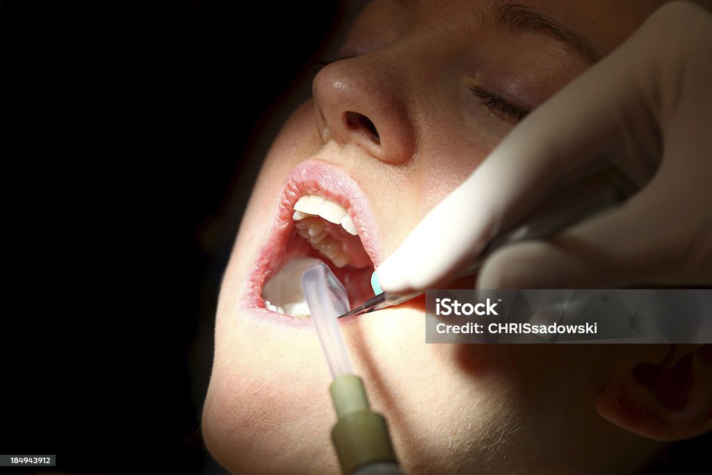 치아용 하이진 - 로열티 프리 건강 진단 스톡 사진