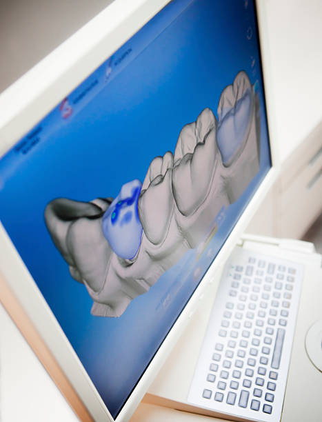 デジタル x 線の人間の歯 - machine teeth 写真 ストックフォトと画像