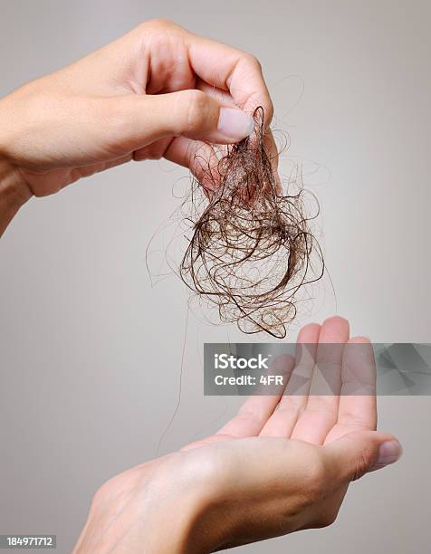 Потеря Волосженщина Держит Вверх Hairball Xxxl — стоковые фотографии и другие картинки Женщины - Женщины, Потеря волос, Только одна женщина