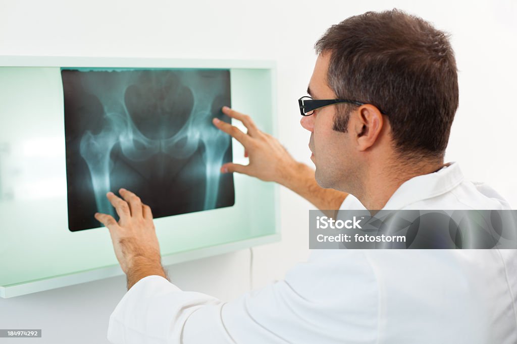 Médico examinar imagen de rayos X - Foto de stock de Cadera libre de derechos