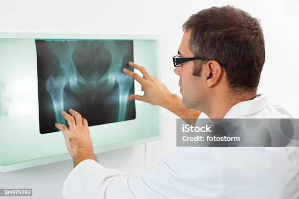 Médico Examinar Imagen De Rayos X Foto de stock y más banco de imágenes de Cadera - Cadera, Imagen de rayos X, Pelvis