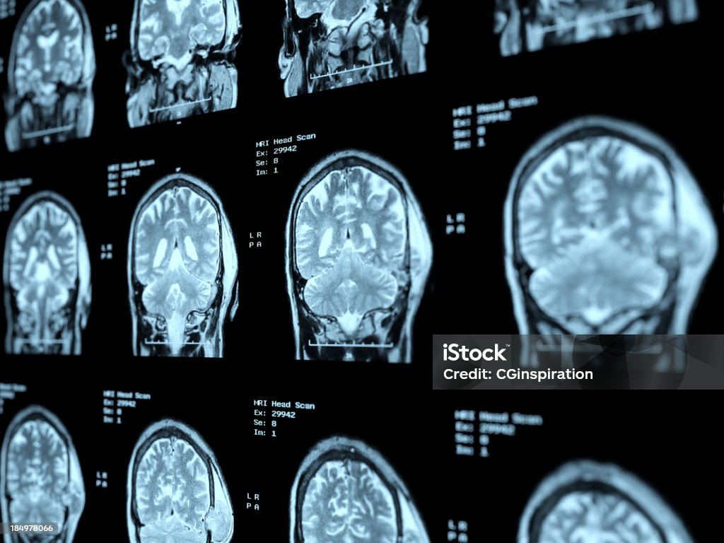 MRI Head Scan Perspective  Medical X-ray Stock Photo