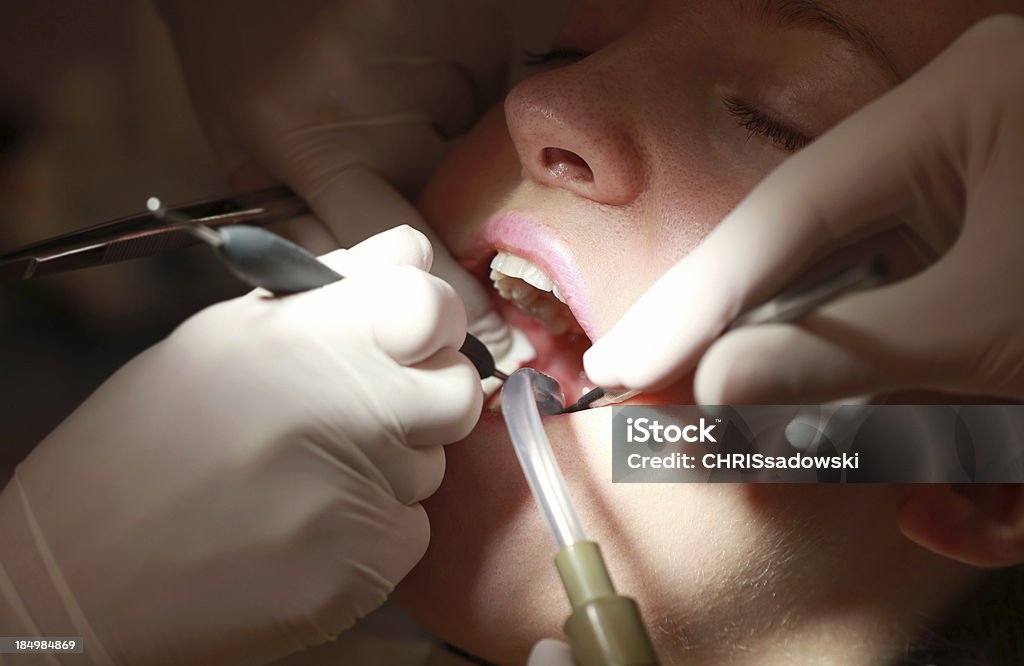 Visita al dentista - Foto de stock de Canal radicular libre de derechos