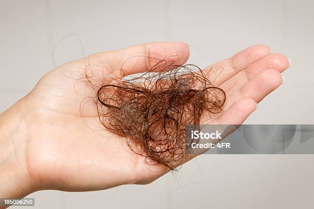 Perdita Di Capellidonna Mostrando Un Hairball Xxxl - Fotografie stock e altre immagini di Perdita di capelli