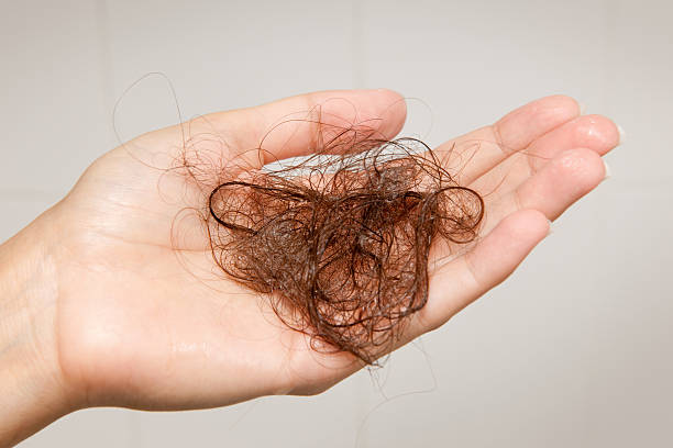 Hair Loss - Woman holding up a Hairball (XXXL) stock photo