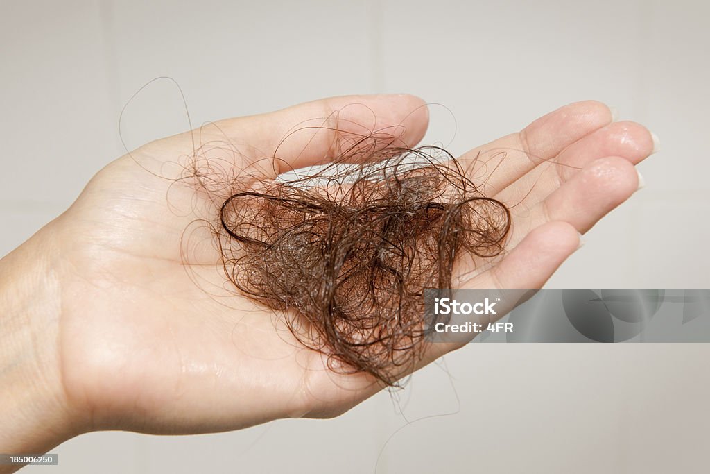 Perda de Cabelo de mulher segurando uma Hairball (XXXL - Foto de stock de Perda de Cabelo royalty-free